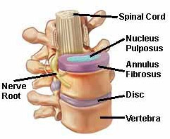 Herniated disc and spinal anatomy