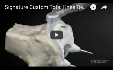 signature-custom-total-knee