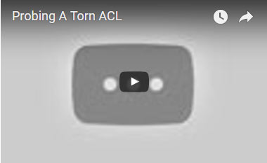 Probing a Torn ACL